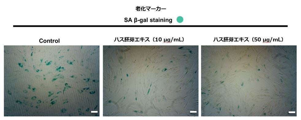 図2:ハス胚芽エキスは老化皮膚線維芽細胞のSA β-gal発現を抑制したことから細胞老化を「回復」させたと考えられました。