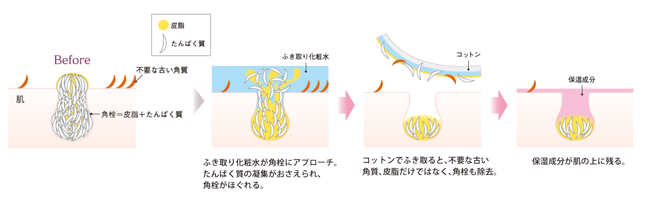 〈うるおいを与えながら角栓をふき取る、「スキンリピュア処方」イメージ図〉