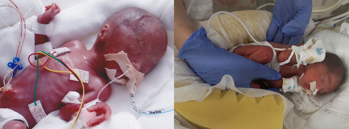 リトルベビーハンドブック と 母乳バンク を知るための カネソンセミナー を開催 カネソン株式会社のプレスリリース