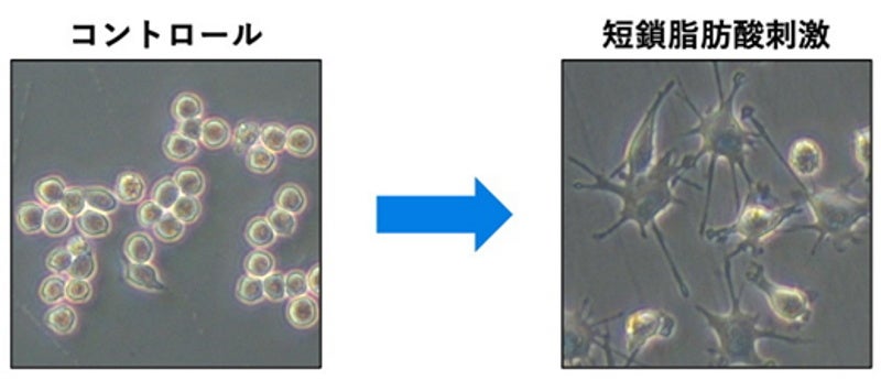 短鎖脂肪酸による樹状細胞の突起伸長誘導