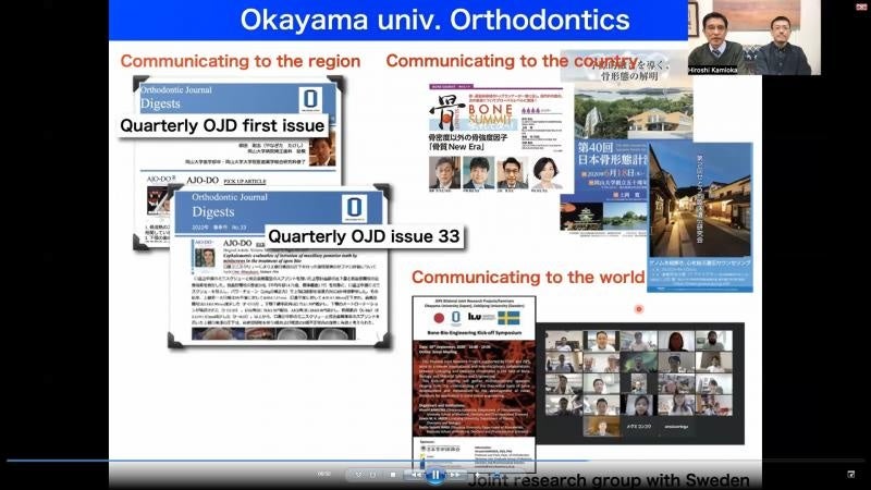 上岡教授による歯科矯正学分野の紹介