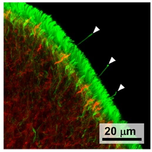 チューブリン（緑）とアクチン（赤）の蛍光標識（矢頭，感覚毛）