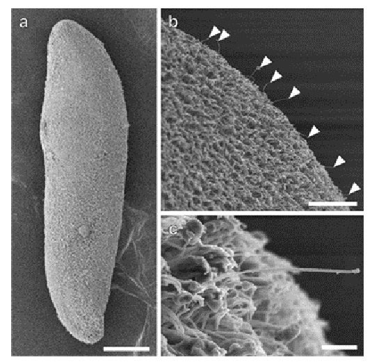 ナイカイムチョウウズムシの体表面の構造（矢頭，感覚毛）