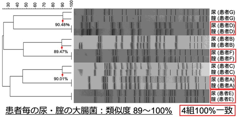 パルスフィールド電気泳動によるデンドログラム