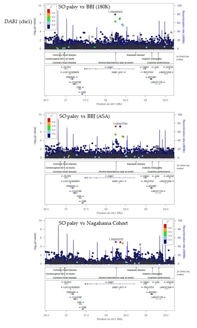 図. 特発性上斜筋麻痺(SO palsy)の患者群と3つの対照集団(BBJ (180K), BBJ (ASA), Nagahama Cohort)を比較した全ゲノム関連解析で、共通に検出されたDAB1遺伝子