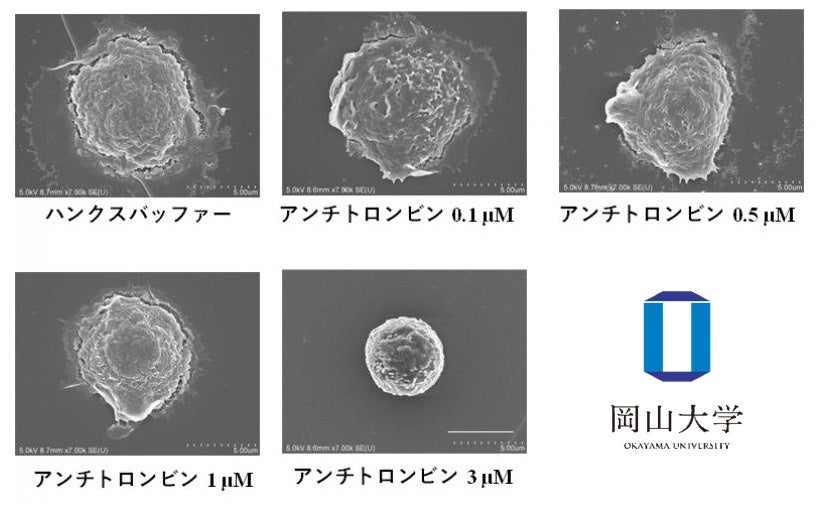 ヒト好中球のアンチトロンビンによる形態変化(走査電子顕微鏡写真)