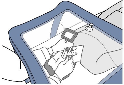 気道確保イメージ