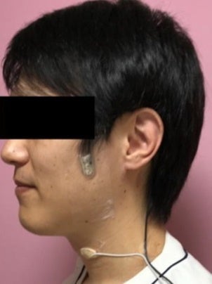 携帯型小型装置