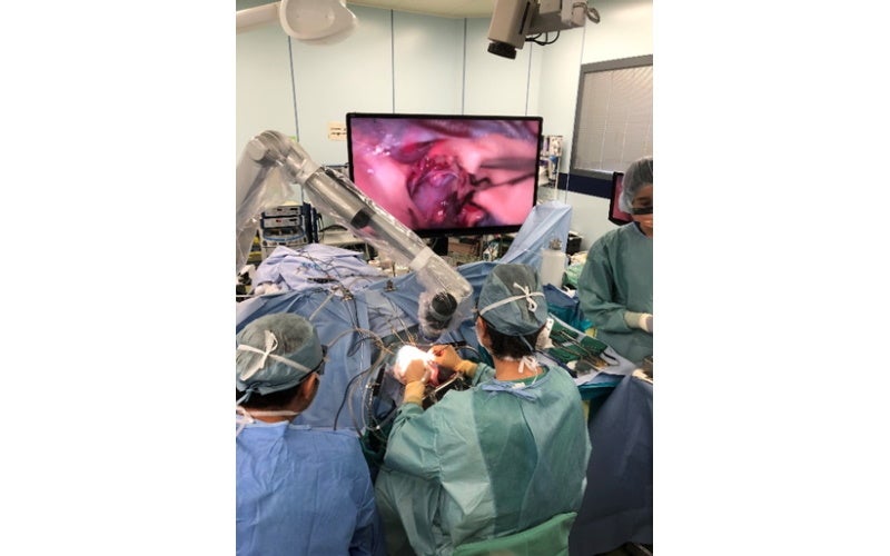 ORBEYEを使って手術する伊達教授