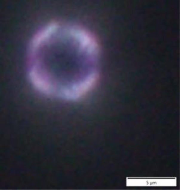 古墳人の歯石から検出された「炊いたコメ」と思われるデンプン粒の像。スケールは5マイクロメートル。