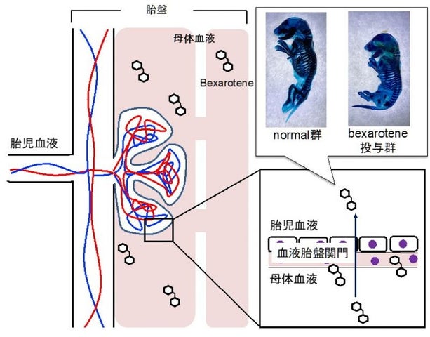 本研究成果で明らかとしたbexaroteneのラット催奇形性と胎児移行性の概念図（論文中の図を改変）