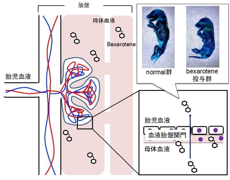 本研究成果で明らかとしたbexaroteneのラット催奇形性と胎児移行性の概念図(論文中の図を改変)
