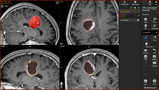 画像が削除されました