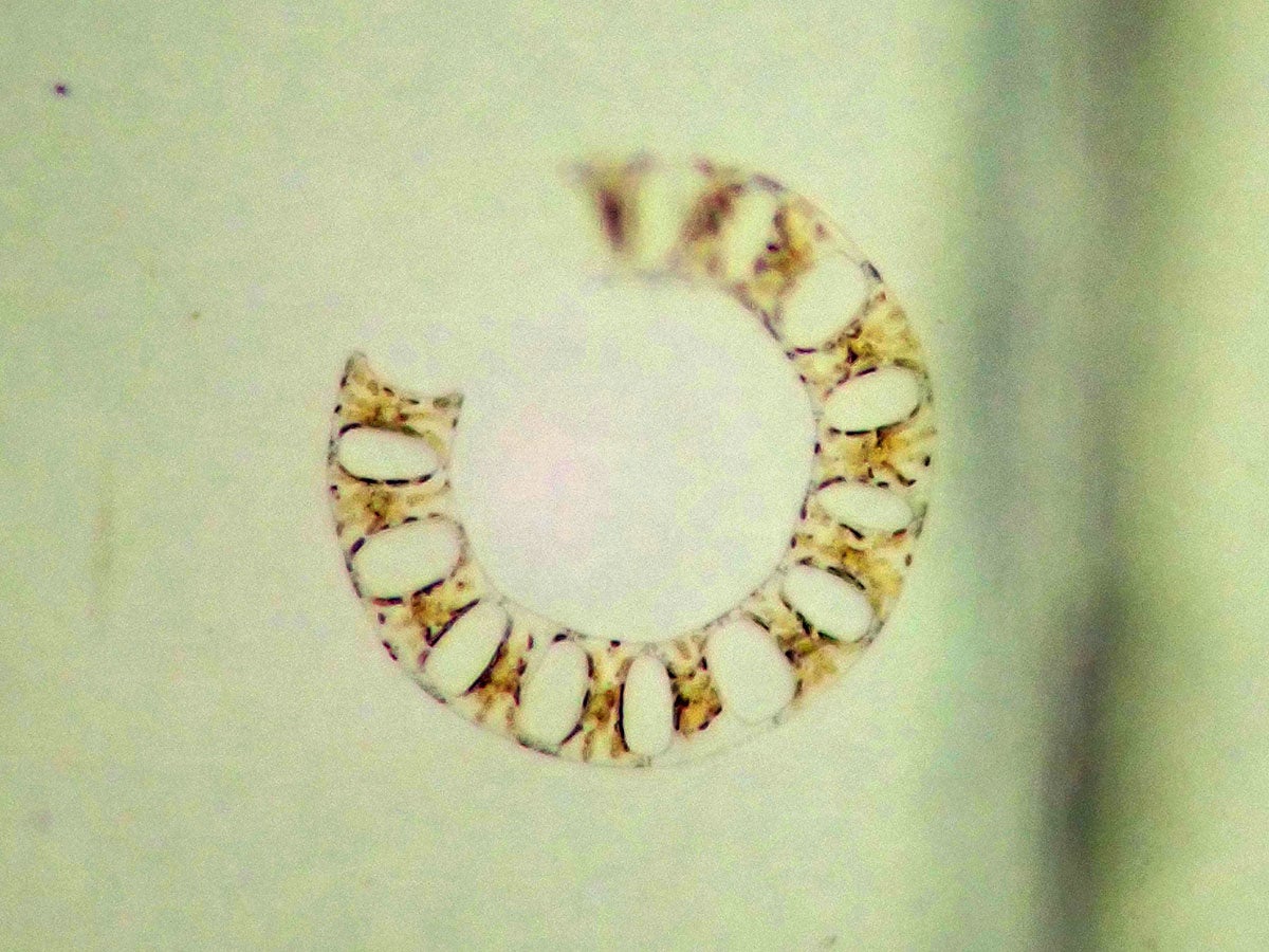 ハシゴケイソウの仲間