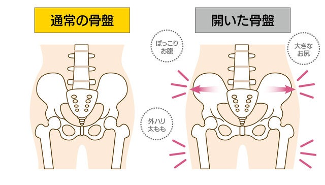 U-15 骨盤 骨盤まわり引き締めキュッと小尻「Cellsh骨盤ホールドクッション」の一般販売開始! | 株式会社ニーズのプレスリリース