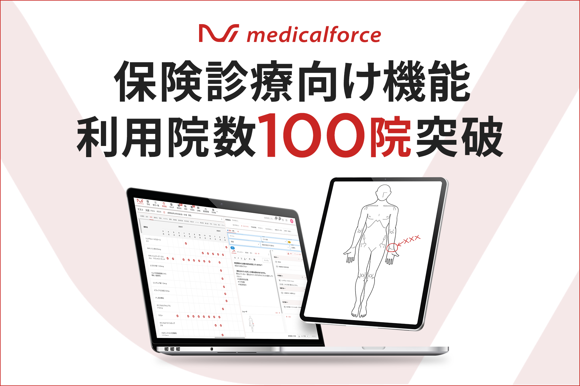 medicalforce、保険診療での導入実績100院を突破