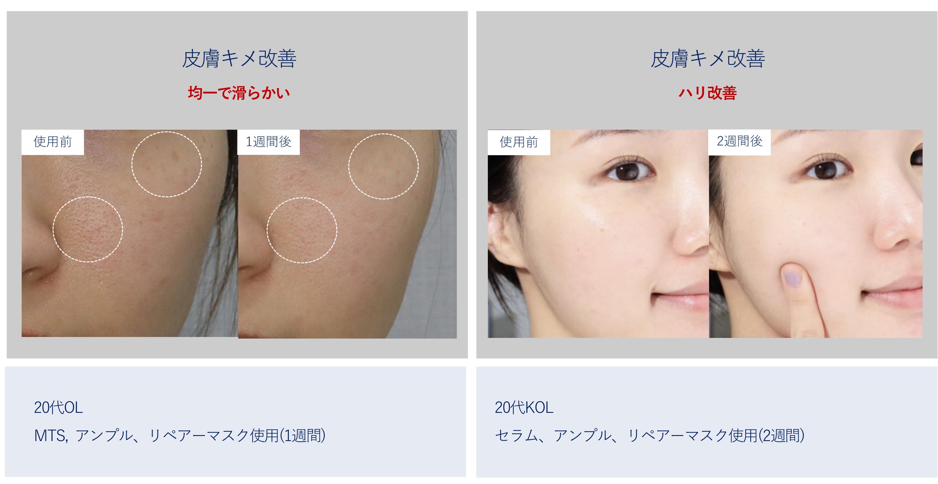 シンビジャパンより先行販売！40年の研究200億ウォンの投資で