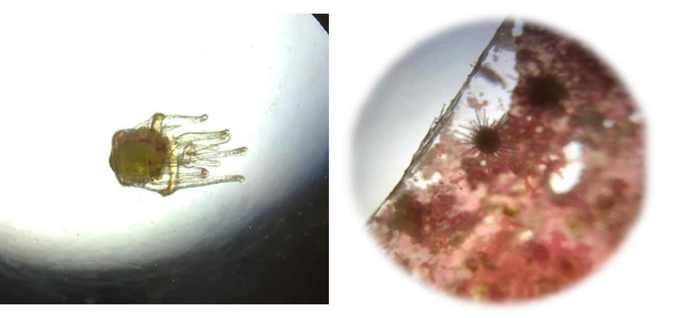 育てた幼生（左）と変態誘導して誕生した稚ウニ（右） いずれもコンテスト参加作品より