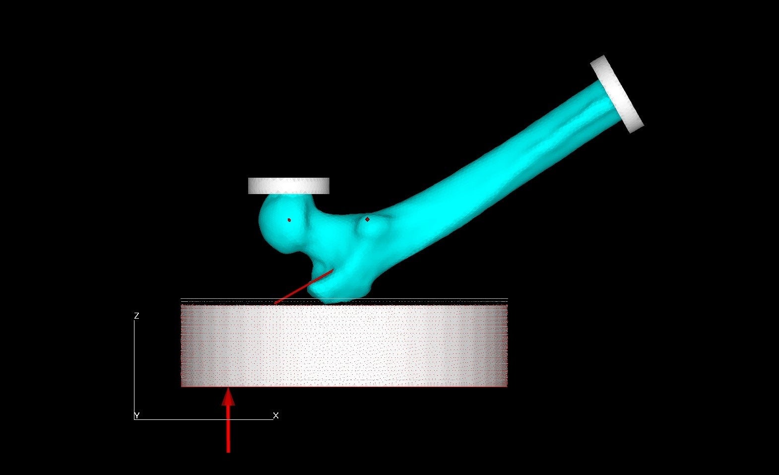 図2：CT有限要素解析による転倒モデルのシミュレーション