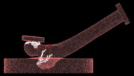 図２. CT有限要素解析モデルによる転倒衝撃吸収床材（ころやわ、22mm厚）の脆弱性大腿骨近位部骨折予防効果のシミュレーション