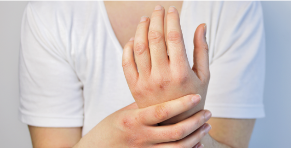 セーフタッチネオ_つらい手荒れ