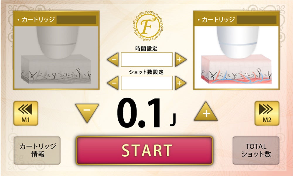 FORTUNA FISUL(フォルトゥナ フィッソ) - 業務用ハイフ(HIFU