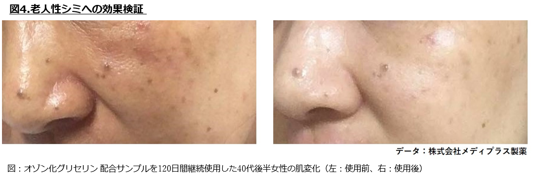 老人性シミへの効果検証