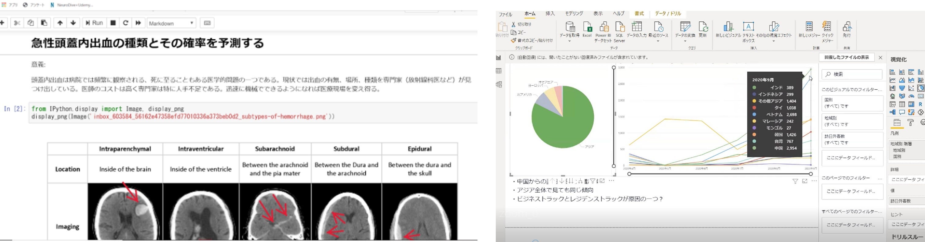 Neuro Dive利用者による成果物例 (Python)（左：転移学習を用いた頭蓋骨出血の画像判定モデル作成&nbsp; &nbsp;右：緊急事態宣言前後における訪日外国人の増減要因分析）