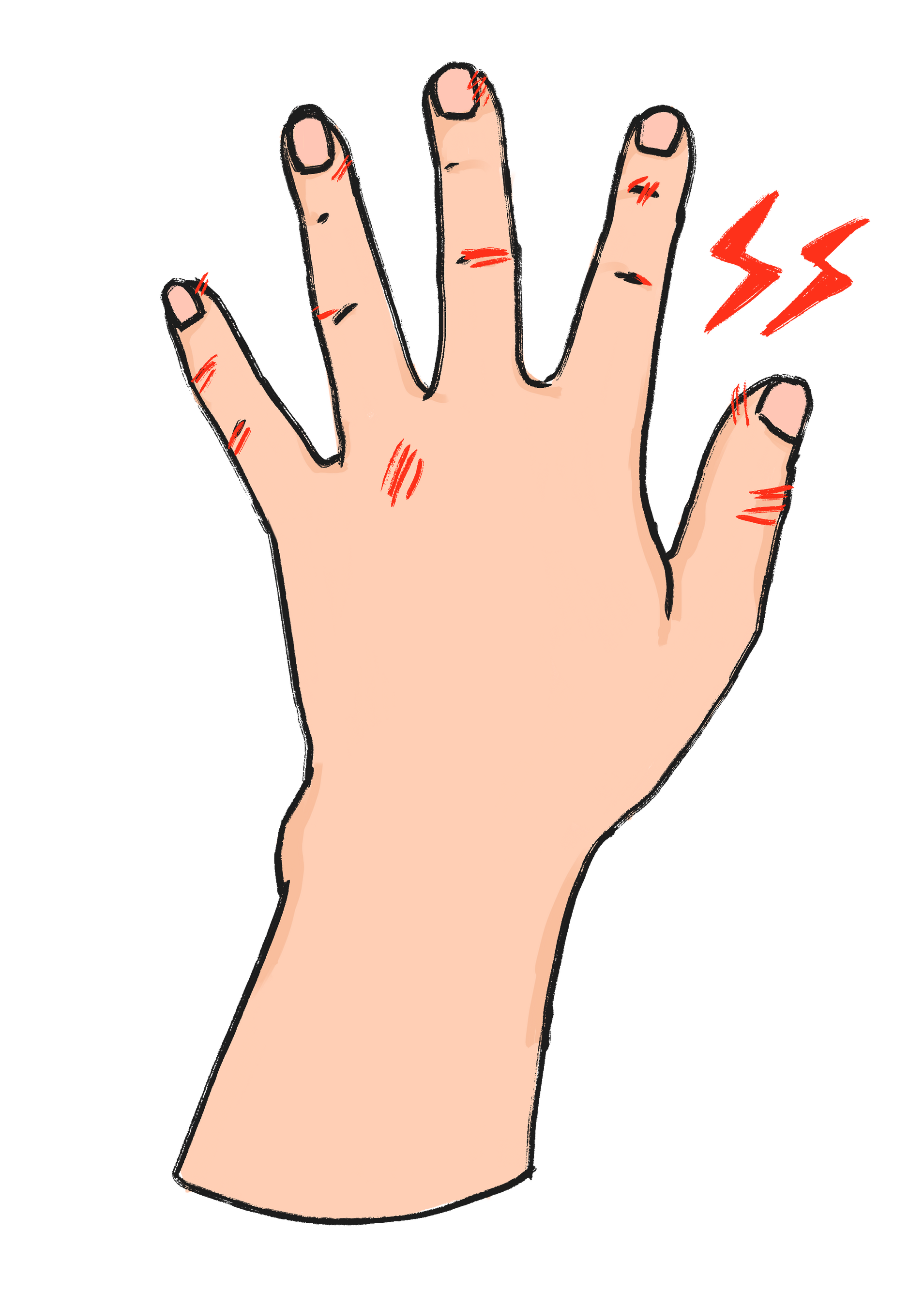 手荒れにより食中毒のリスクが増加