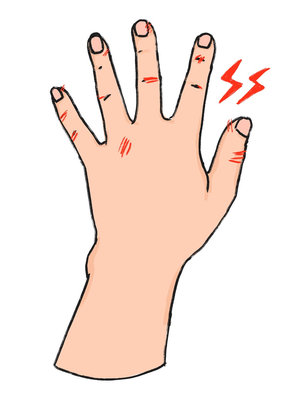 手荒れにより食中毒のリスクが増加