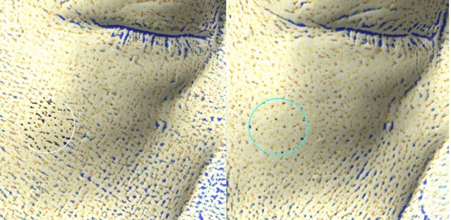 【毛穴】左：before、右：after