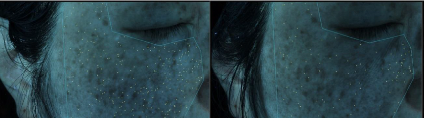 【ポルフィリン】左：before、右：after