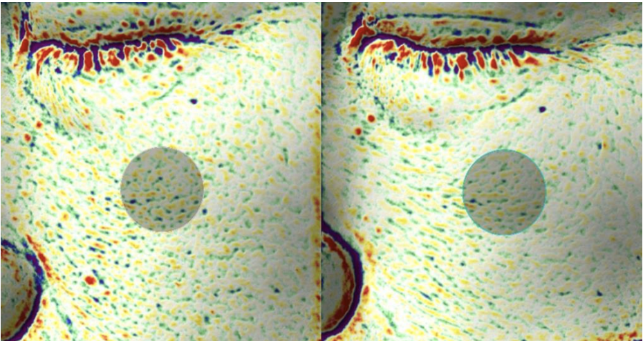 【肌のキメ(なめらかさ)】左：before、右：after