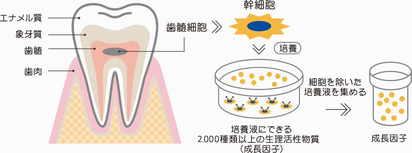 乳歯から歯髄を採取し培養上清液を回収するイメージ図