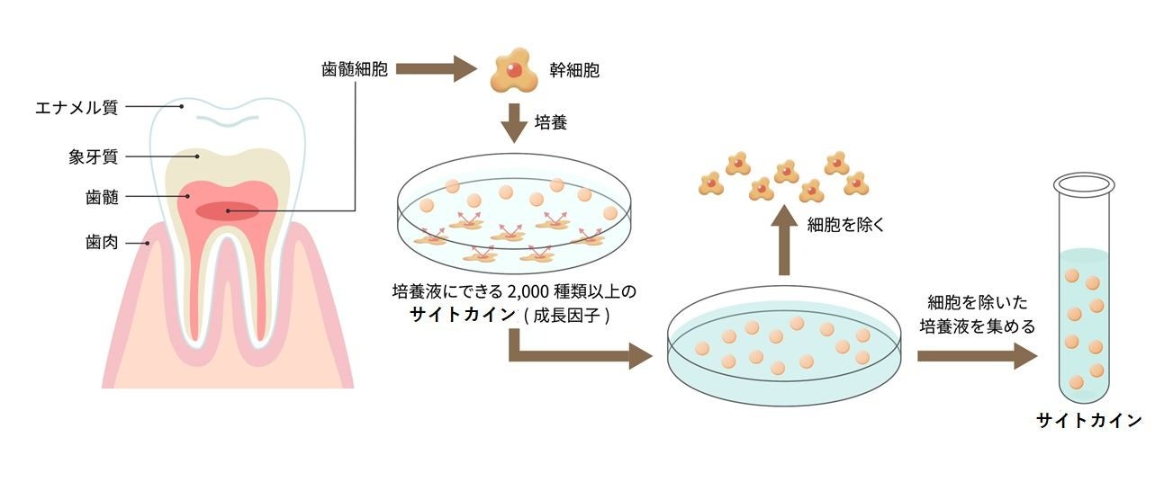 乳歯由来歯髄幹細胞培養上清液の精製工程のイラスト図