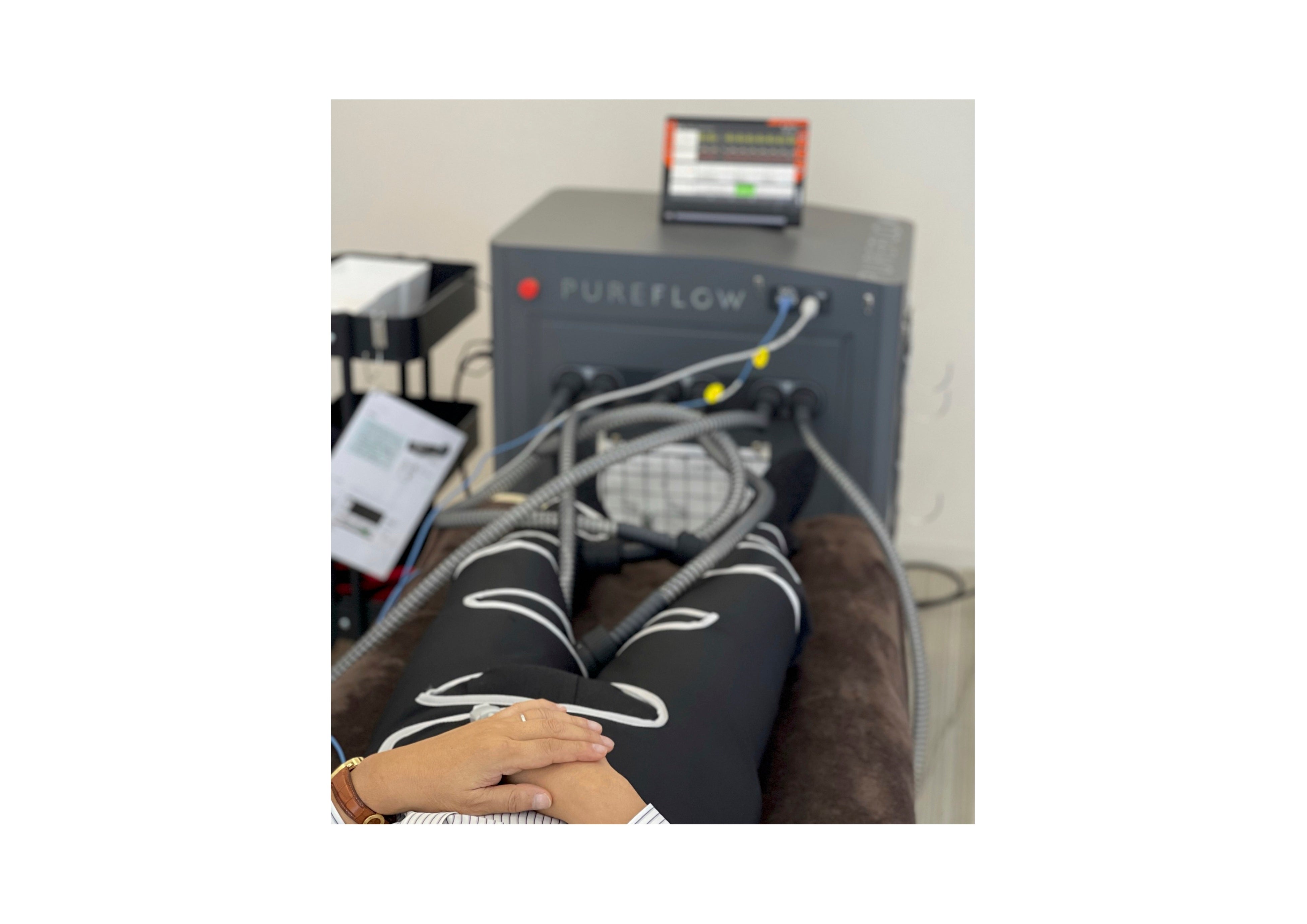 ＥＥＣＰ療法の様子。ふくらはぎ・太もも・臀部に巻いた専用カフに、心拍とのリズムで圧力をかけることで血液循環を目指す