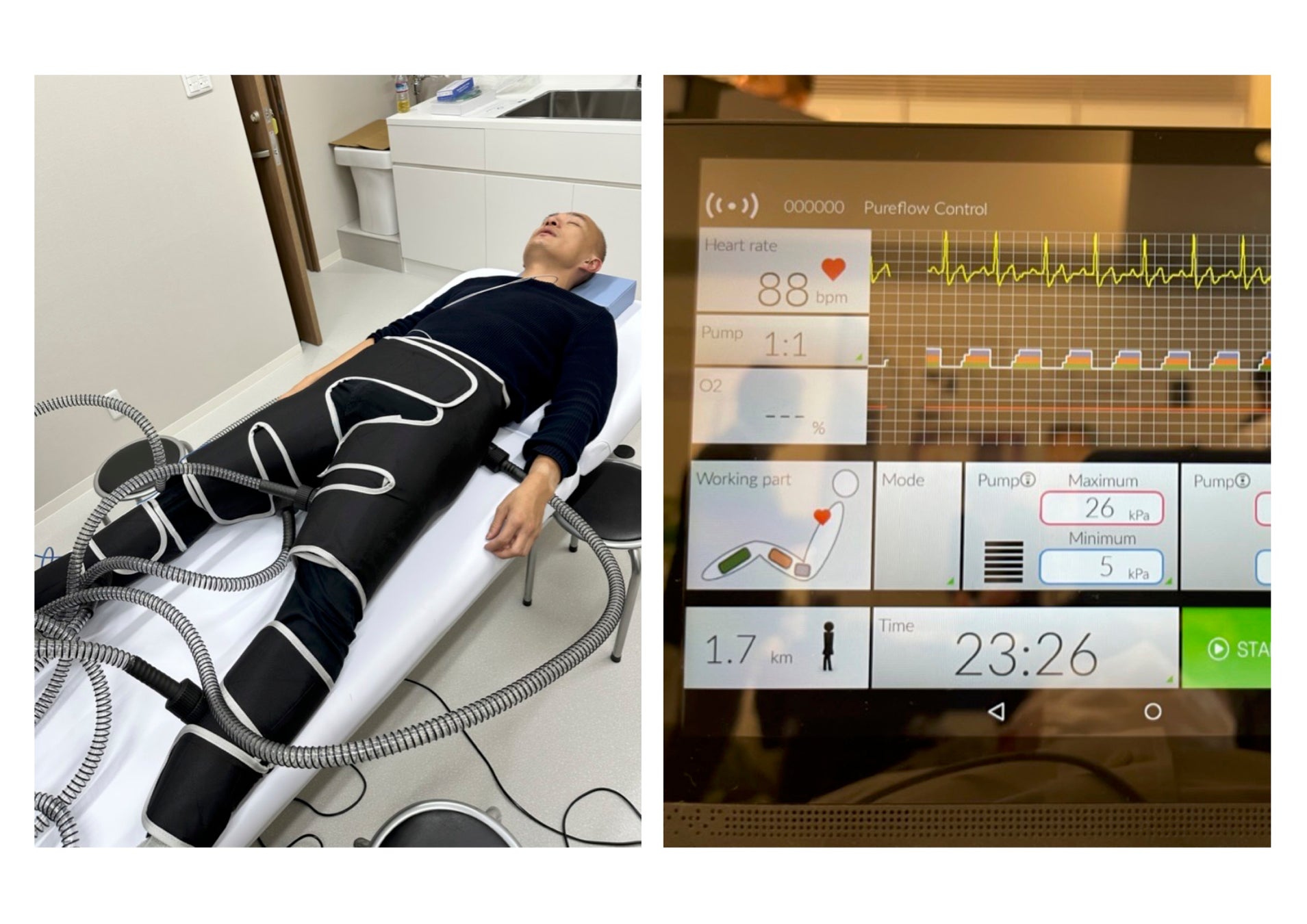 (左)服を着たまま施術が可能。寝ているだけで有意義な血流循環を促す。(右)心拍を測定しながら施術をする。心拍に連動したリズムでの加圧により、心臓への負荷なく血流を加速させることができる。