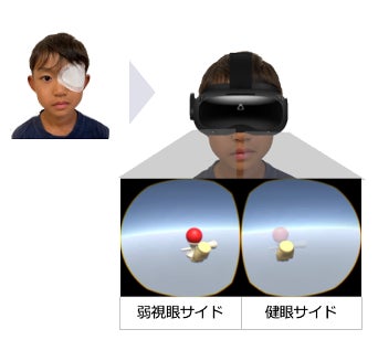 医療スタートアップのInnoJin株式会社が大阪・関西万博にて「ROHTO Healthcare DAY~Feel Science & Passion~」へ参加 医療スタートアップのInnoJin株式会社が大阪・関西万博にて「ROHTO Healthcare DAY~Feel Science & Passion~」へ参加