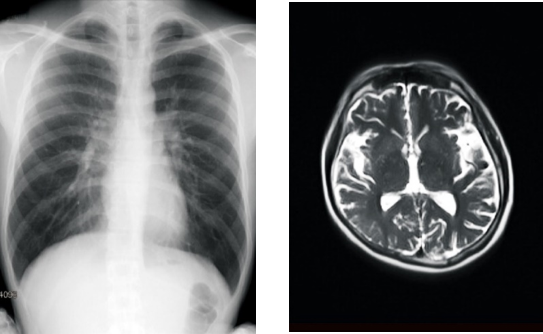 「カルテコ」で閲覧できるようになる検査画像のイメージ