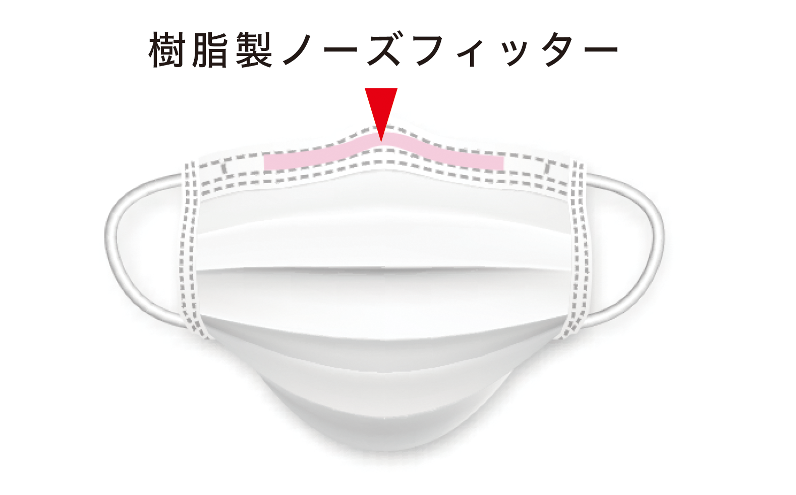 樹脂製ノーズフィッターを使用