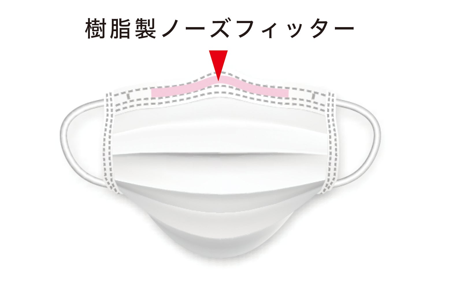 樹脂製ノーズフィッターを使用