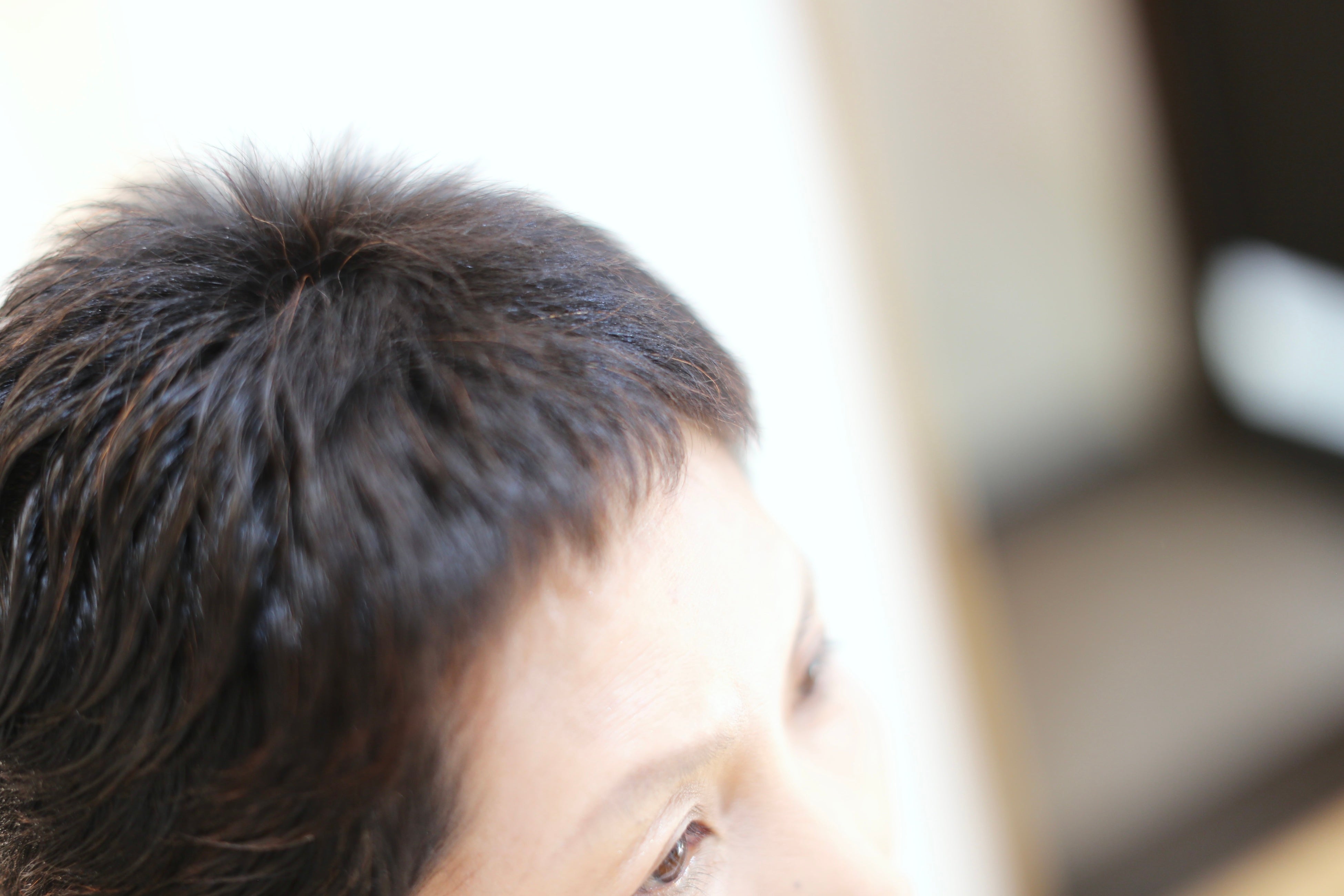 ビフォー　生えかけた毛髪