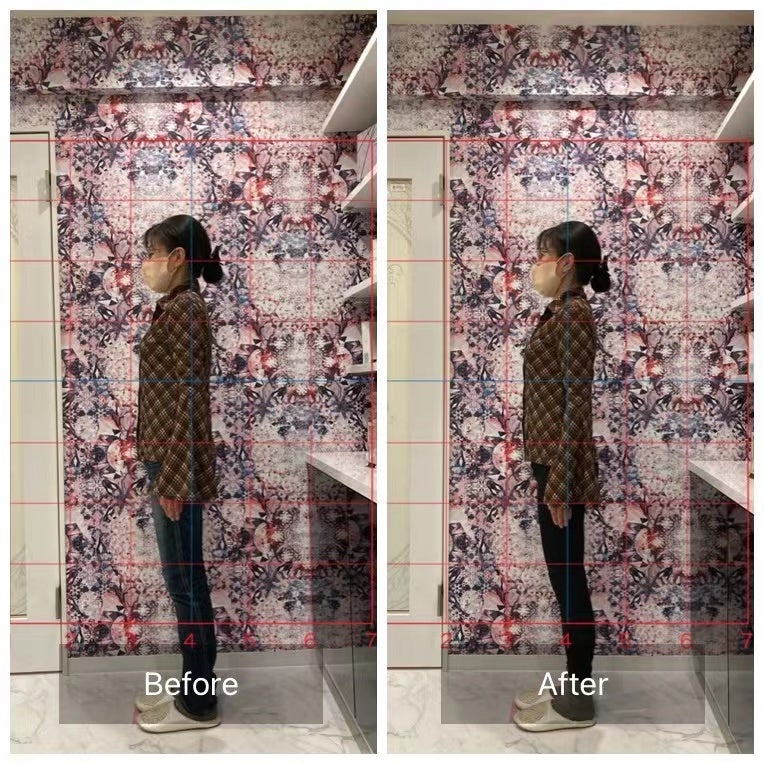 骨盤底筋ビフォーアフター