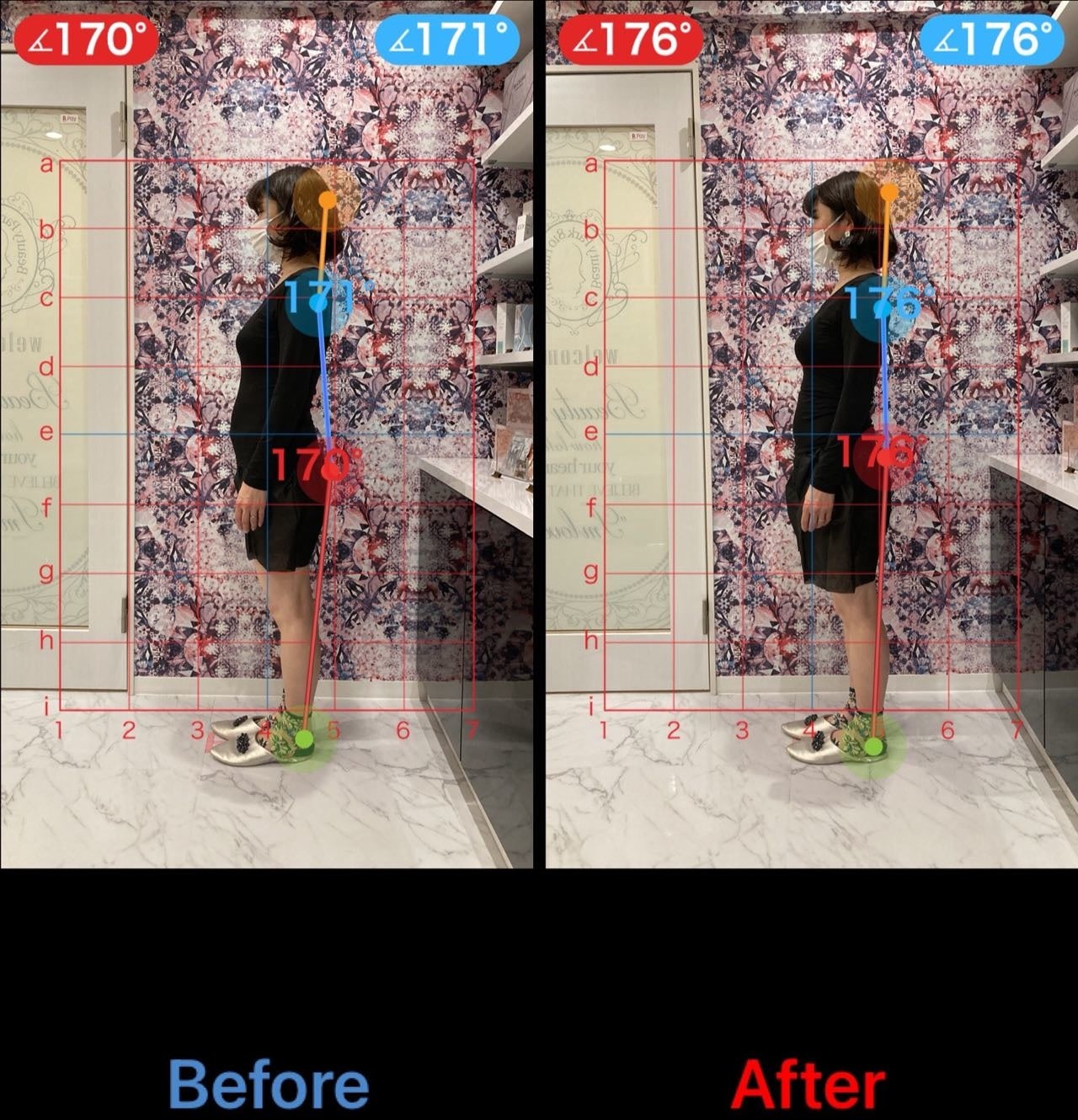 フェムテックビフォーアフター