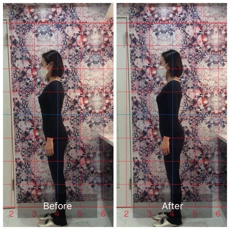 骨盤底筋ビフォーアフター