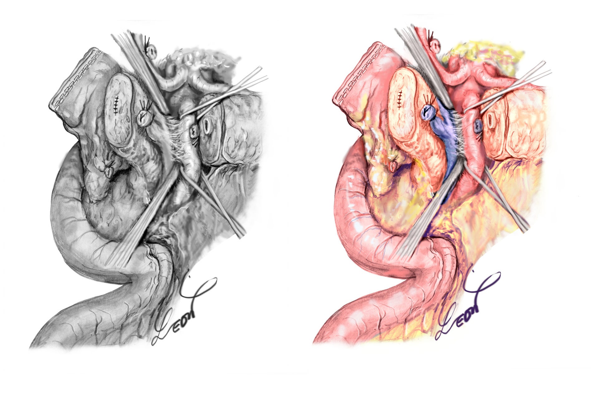 メディカルイラストレーターのレジェンド レオン佐久間 の原画展 紀伊國屋書店グランフロント大阪店にて3月22日より開催 Lkmacのプレスリリース メディカルイラストレーターのレジェンド レオン佐久間 の原画展 紀伊國屋書店グランフロント大阪店にて3月22日より開催 Lkmacのプレスリリース
