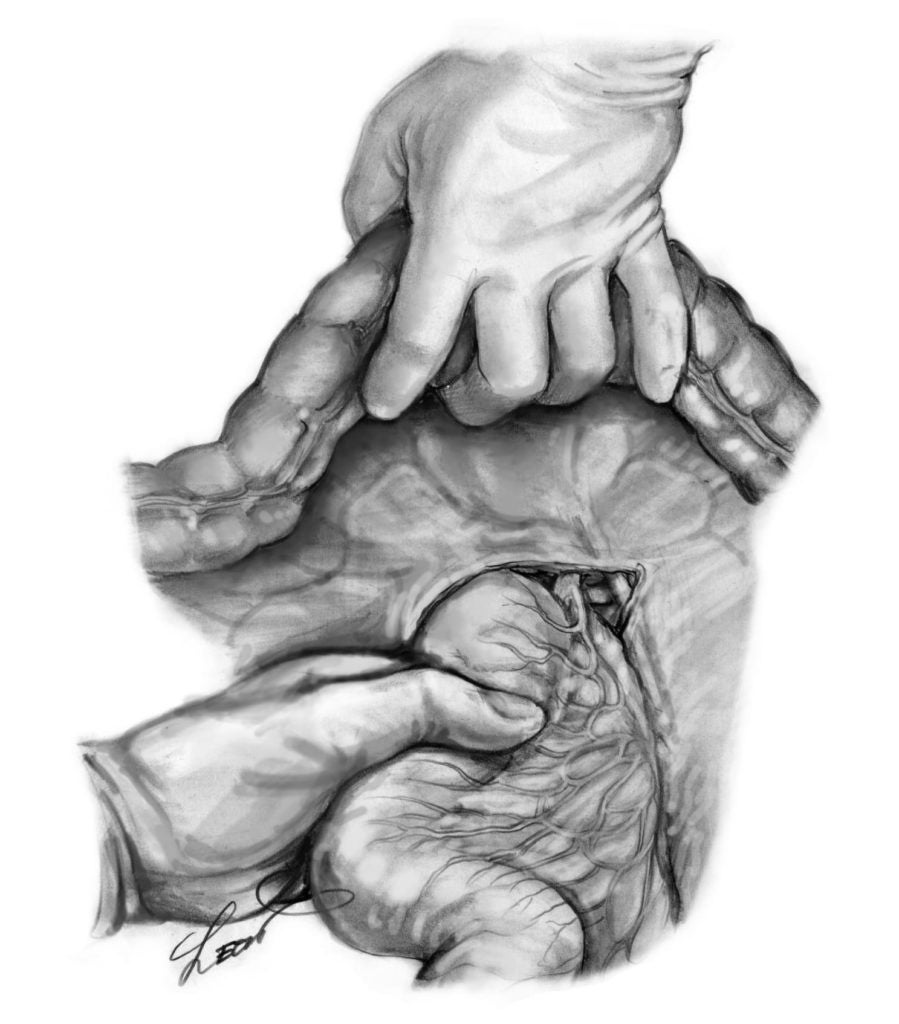 メディカルイラストレーターのレジェンド レオン佐久間 の原画展 紀伊國屋書店グランフロント大阪店にて３月２２日より開催 Lkmacのプレスリリース