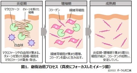 代表的な症状とピアスの日ごとのアフターケア