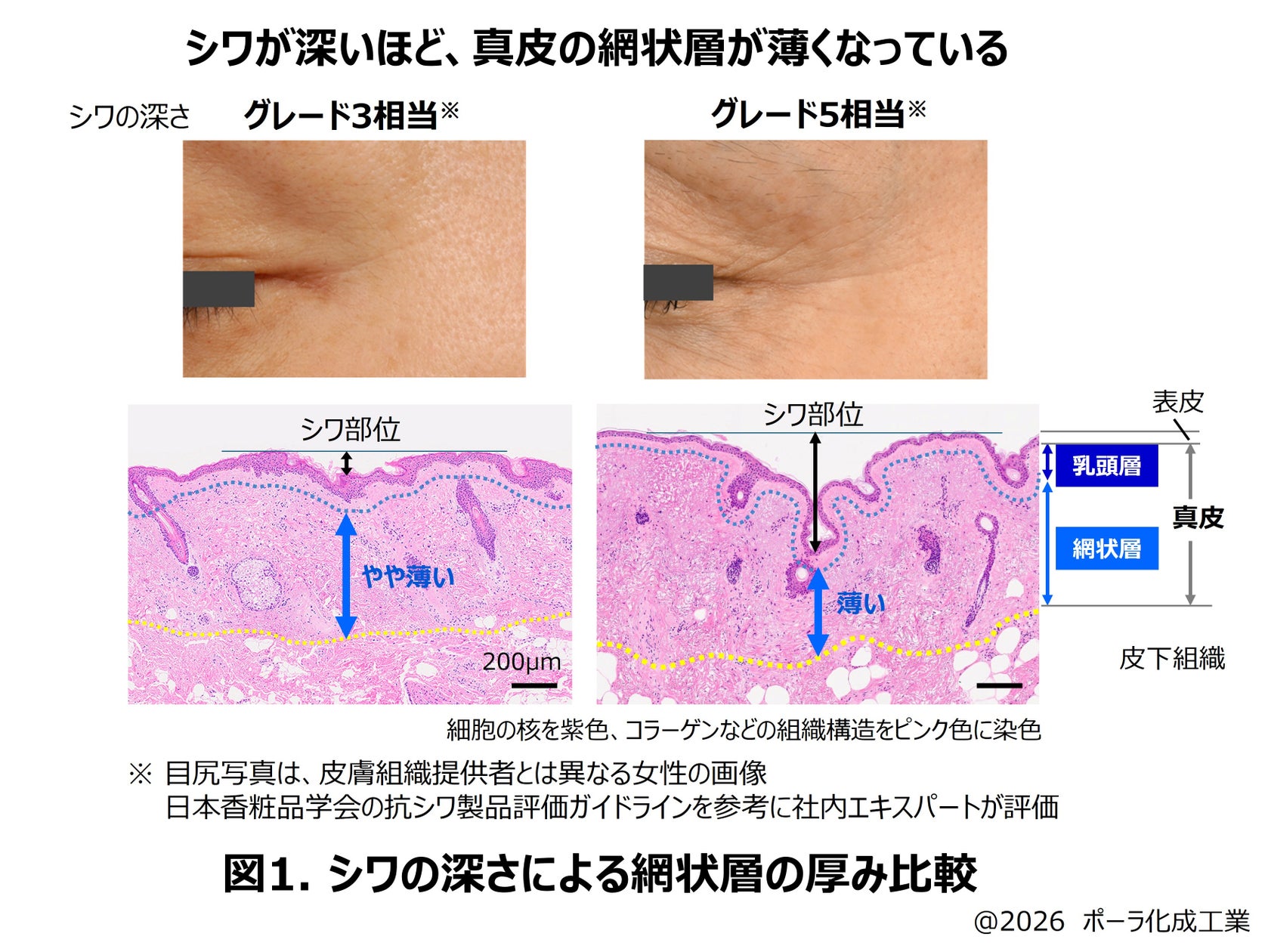 なぜシワは表情で動く場所にできやすいのか