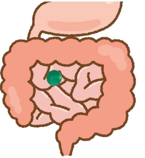 水で膨らむボールの誤飲により消化管内で膨張するイメージ